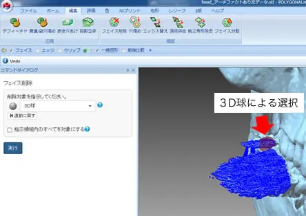 POLYGONALmeisterで3D球を使って頭蓋骨の一部を選択している画面