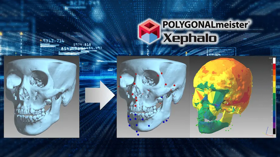 デジタル背景上で、頭蓋骨の3Dデータ解析を行うPOLYGONALmeister Xephaloのイメージ