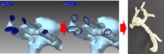 枝分かれした3Dメッシュモデルの穴埋め・切断処理と、最終的な3Dプリント用パーツへ仕上げた工程を示す比較画像