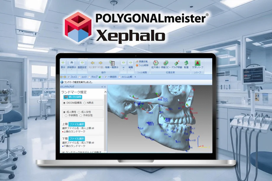 歯科医院内のノートパソコン画面に、POLYGONALmeister Xephaloによる顎骨の3D解析画像が表示されている様子