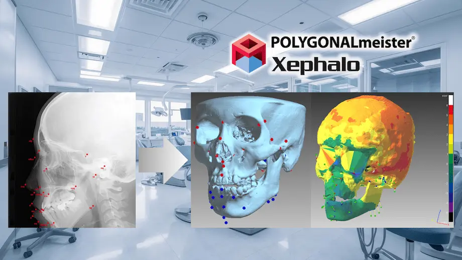 歯科用レントゲン画像から3D頭蓋骨解析へ変換するPOLYGONALmeister Xephaloの解析イメージ