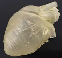 心臓CTデータを修正後、光造形3Dプリンタで実物大心臓モデルを透明樹脂で造形した完成写真