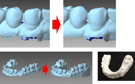 スキャンした歯列の荒れたメッシュをPOLYGONALmeisterで修正し、滑らかな歯型モデルと3Dプリント品へ仕上げたビフォーアフター例。