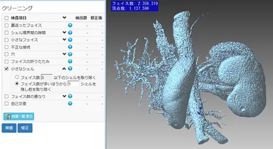 POLYGONALmeisterでCTスキャン由来の腎臓と腎血管を3Dメッシュ化し、ノイズ除去や穴埋めなどのクリーニング設定を表示した画面