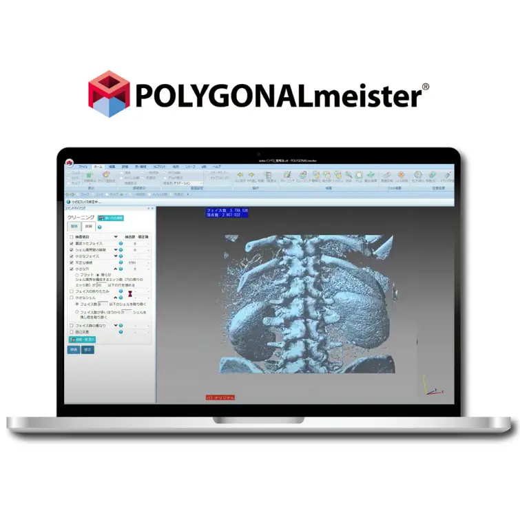 POLYGONALmeisterでCTスキャン由来の腰椎・肋骨・腎臓を3Dメッシュ化し、ノイズ除去とリメッシュをしている画像