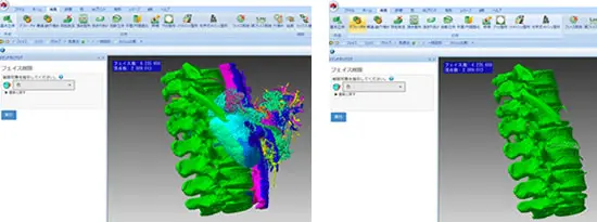 POLYGONALmeisterでCTスキャン由来の腰椎3Dメッシュをフェイス削除処理前後で比較。左はセグメンテーションで色分けされた元データ、右は不要フェイスを除去してクリーンアップしたメッシュを表示した画像。
