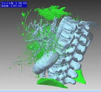 POLYGONALmeisterでCTスキャン由来の腰椎3Dメッシュを表示し、緑色でノイズ点群を可視化してノイズ除去をしている画像
