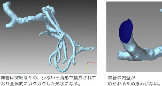 微細な三角ポリゴンでカクつく血管モデルと、内壁が取得できず厚みがない断面例を示す画像